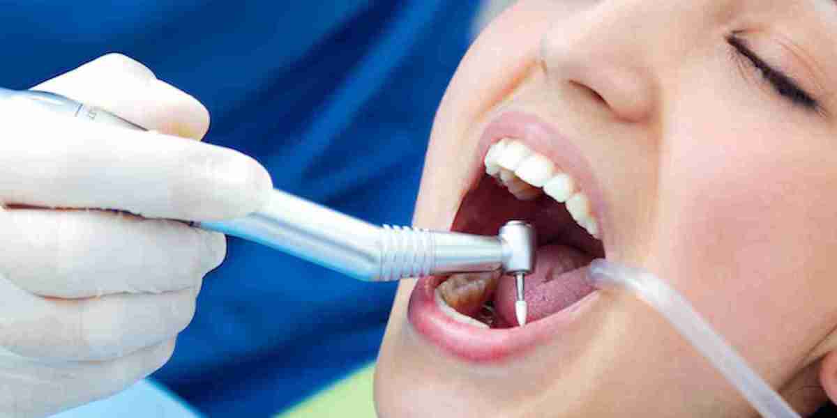 Benefits of Choosing Dental Sealant Near Me for Cavity Prevention