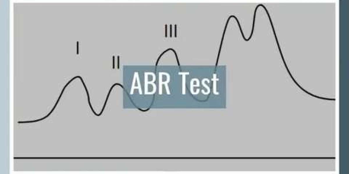 Understanding ABR Test and ASSR Test for My Newborn Daughter