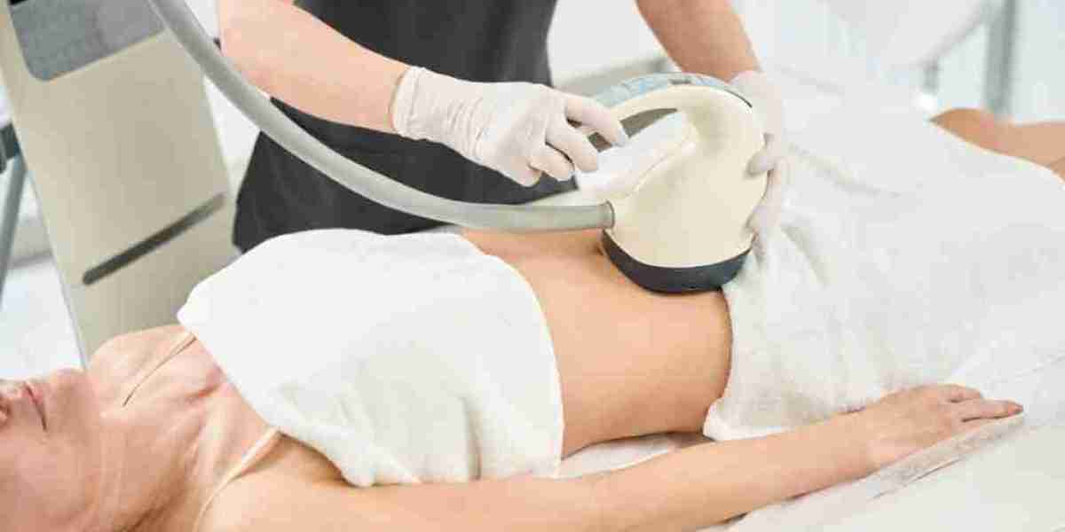 What is the Future of Velashape 3 Treatment?